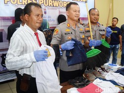 Siswi Korban Penyiksaan 3 Siswa SMP Purworejo Alami Luka Lebam