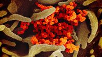 Begini Wujud Virus Corona  Dilihat dari Mikroskop