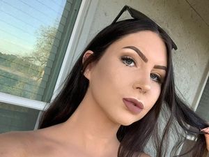 Foto: Wanita Alami Luka Bakar di Seluruh Wajah, Transformasinya Menakjubkan