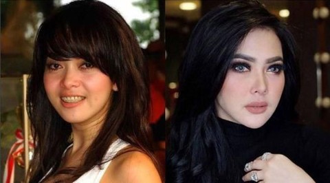  Dulu  VS Sekarang Ini Transformasi Wajah Artis Indonesia 