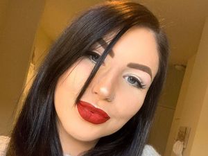 Kisah Wanita Alami Luka Bakar di Seluruh Wajah, Transformasinya Menakjubkan