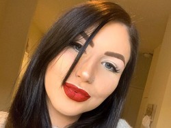 Kisah Wanita Alami Luka Bakar di Seluruh Wajah, Transformasinya Menakjubkan