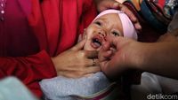 Pemberian Vitamin A untuk Cegah Stunting