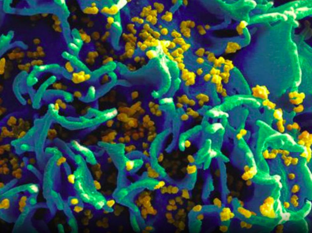 10 Virus dan Bakteri yang Dipakai Senjata Biologis Mematikan