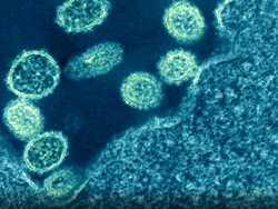 Lebih dari 6.000 Orang Terinfeksi di China, Apa Itu Wabah Brucellosis?