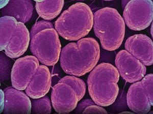 AS Laporkan Wabah Bakteri Langka, Catat Kasus Kematian