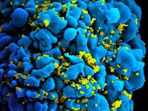 Foto Mikroskopis Bermacam Virus dan Bakteri