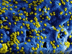 Vietnam Bisa Sembuhkan Semua Pasien Corona, Begini Caranya