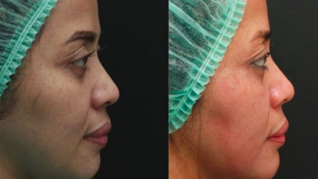 Muzdalifah hilangkan double chin
