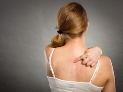 6 Cara Mengatasi Jerawat Punggung yang Mudah Dilakukan di Rumah