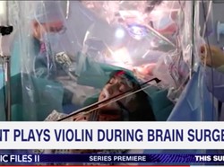 Santuy! Musisi Ini Asyik Main Biola Saat Dokter Membedah Otaknya