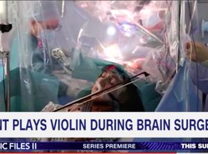 Santuy! Musisi Ini Asyik Main Biola Saat Dokter Membedah Otaknya Santuy! Musisi Ini Asyik Main Biola Saat Dokter Membedah Otaknya