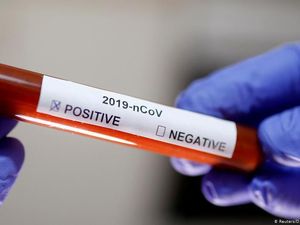 Sejumlah Universitas di AS Pindah ke Kelas Online Akibat Corona