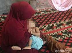 Bocah 16 Bulan di Polman Bergelut dengan Tumor Ganas di Matanya