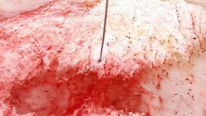 Salju Merah Darah yang Melanda Antartika