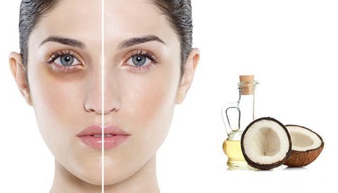 Tubuh Sehat Cantik Dengan Virgin Coconut Oil