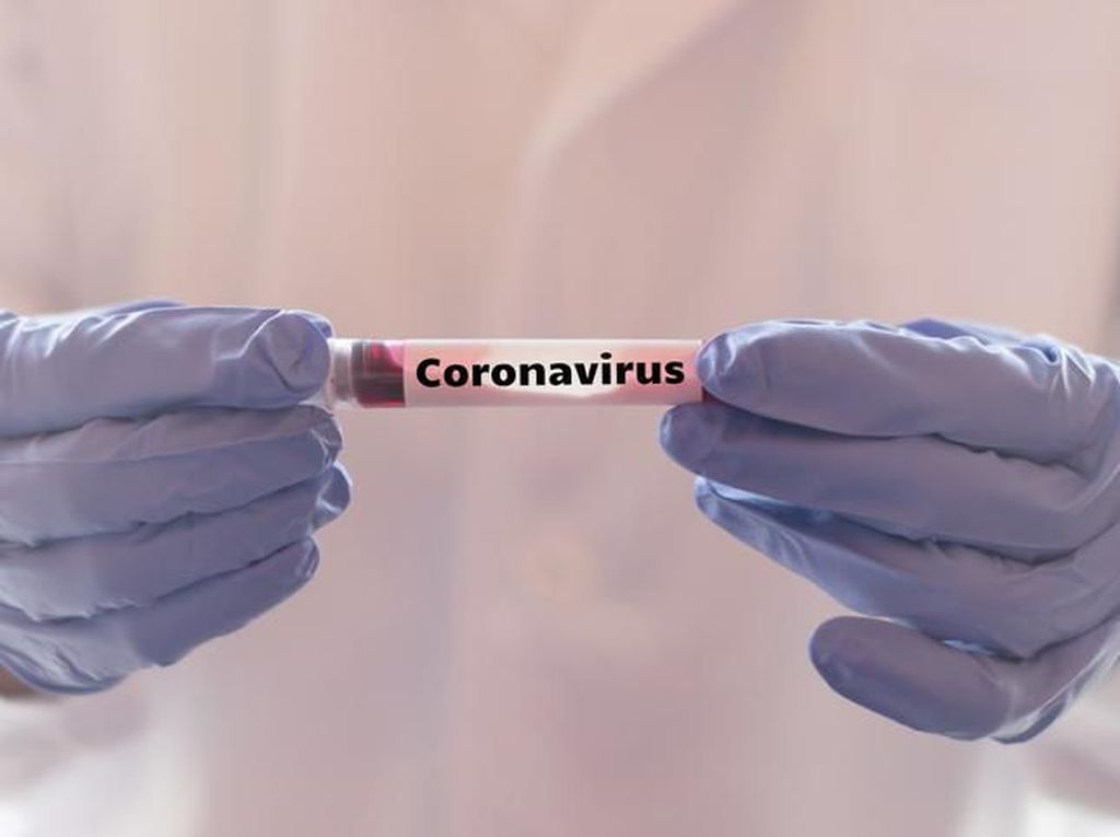 Cegah Penyebaran Virus Corona, Cuci Tangan Hingga Minum Vitamin C
