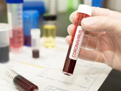 Obat Virus Corona Belum Ada, Ini Tips Agar Kamu Terhindar COVID-19