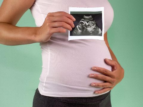 The girl is holding a snapshot of an ultrasound twin in the fourth week of pregnancy. First trimester. Confirmation of pregnancy