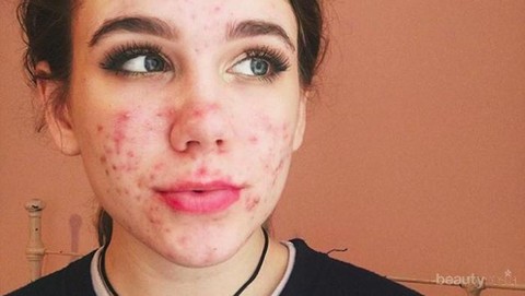 Wajib Tahu Manfaat Si Biru Cantik Kembang Telang Bagi Kesehatan