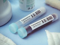 Avigan dan Klorokuin Bisa Mengatasi Gejala plus Obat Virus Corona, Yakin?