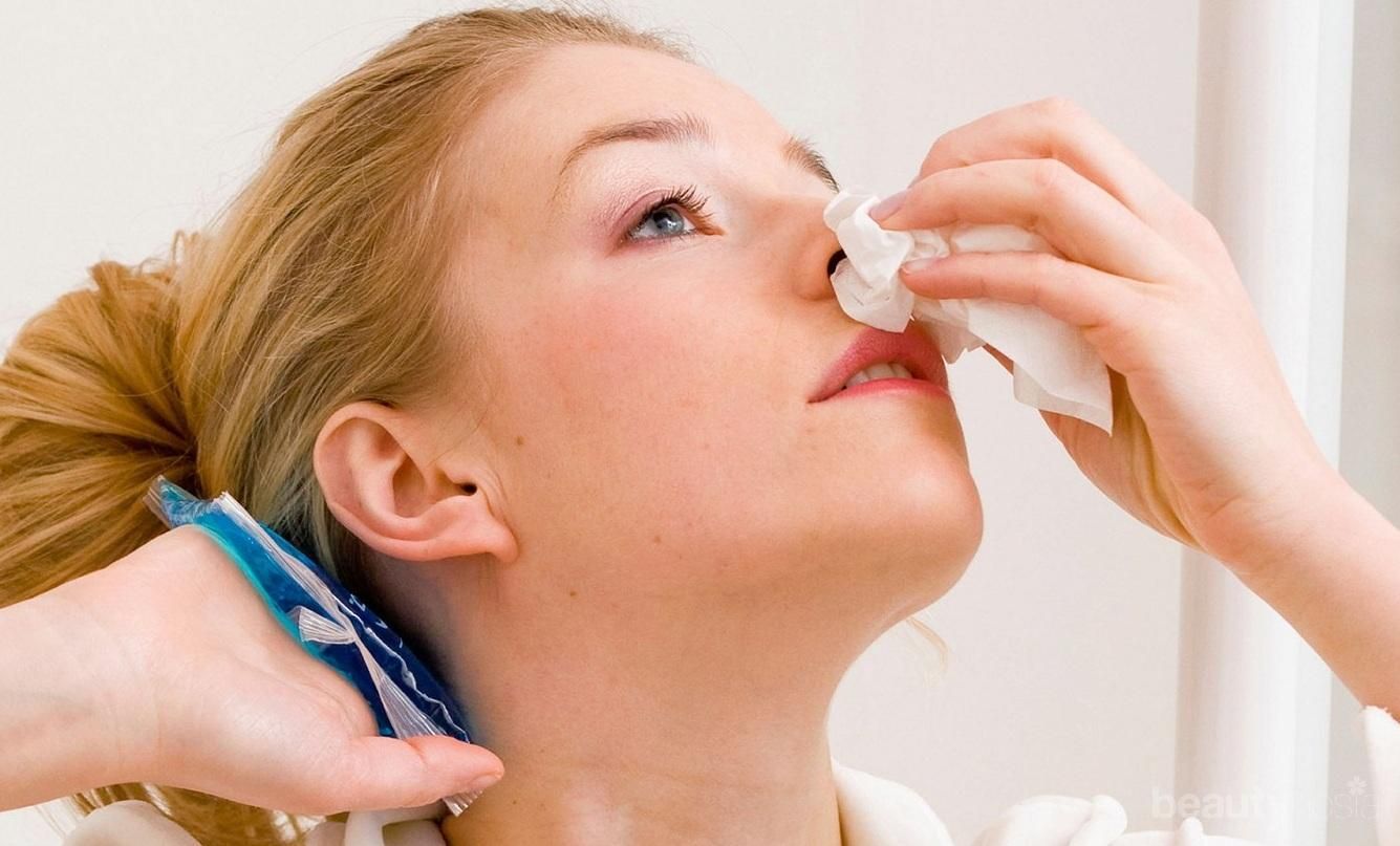 Cari Tahu Penyebab Kamu Terlalu Sering Mimisan di Sini