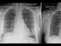 Ilmuwan Australia Ungkap Cara Sistem Kekebalan Tubuh Perangi Virus Corona