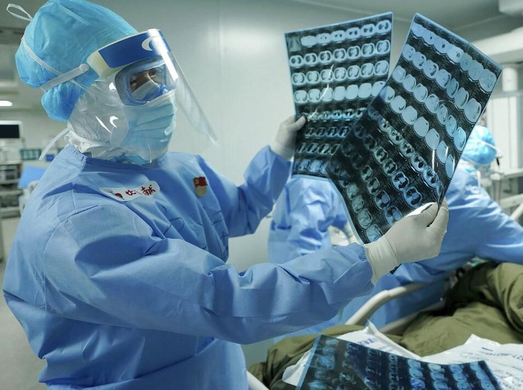 Hantavirus yang Trending Saat Pandemi Corona Dipastikan Bukan Virus Baru