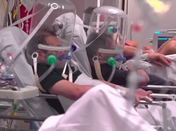 Pasien Corona di Italia Gunakan Bubble Helmet Sebagai Alat Bantu Napas