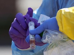 Ilmuwan Terkemuka AS: Virus Corona Bisa Jadi Siklus Musiman!