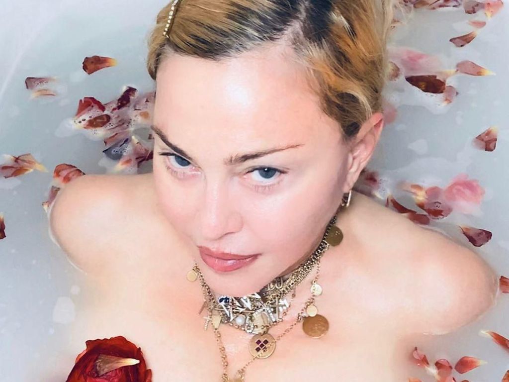 Penampilan Madonna Pamer Bekas Luka Pada Tubuhnya di Medsos dengan Bangga