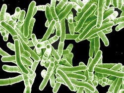 WHO: TBC Tetap Jadi Penyakit Infeksi Paling Mematikan Sedunia