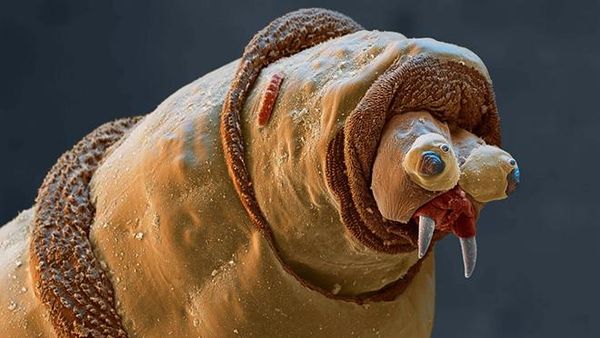 Ngeri atau Imut? Deretan Foto Makhluk Kecil Dilihat dari Microskop