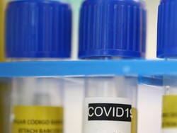 RI Terima Bantuan 50.000 Alat Tes Corona dari Korsel