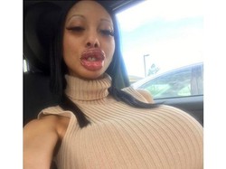 Penampilan Wanita Habiskan Rp 3,3 M Operasi Plastik Ekstrem, Dipuji Dewi