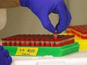 Ahli Sebut CT Scan Lebih Akurat Deteksi Virus Corona Dibanding Tes Swab