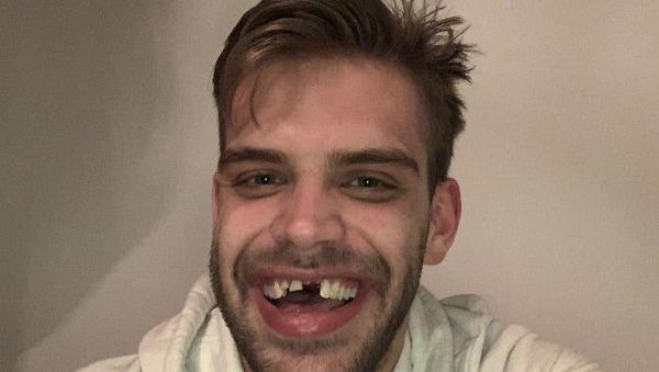 10 Foto Orang-orang Bernasib Buruk Saat Karantina, Kasihan Tapi Lucu