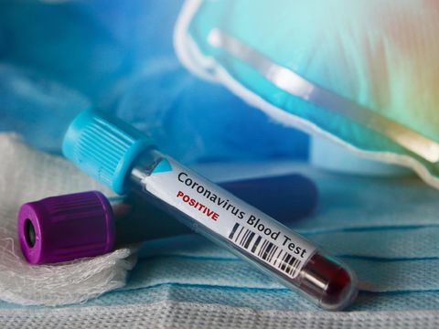 Tertekan dengan Pekerjaan, Dokter yang Tangani Pasien Corona Bunuh Diri
