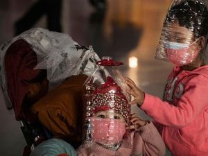 Viral Foto Rontgen Paru-paru Anak PDP di Medan, Bukti Corona Tak Pandang Usia