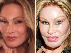 Potret Wanita Doyan Oplas gegara Terobsesi Jadi Catwomen, Mukanya Jadi Begini