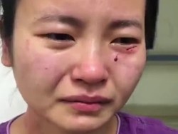 Mau Kabur dari Ruang Isolasi, Pasien Corona Serang dan Gigit Perawat