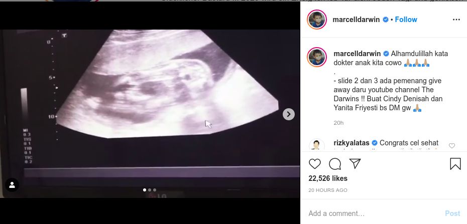 Baru 3 Bulan Nikah, Marcell Darwin Pamer Foto USG Calon Anak Pertama