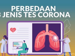 3 Jenis Tes Corona di Indonesia, Perbedaan dan Plus-minusnya