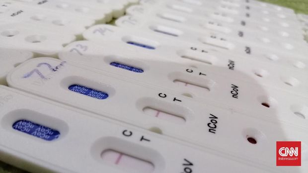 Rapid test atau test cepat massal virus corona (Covid-19) di Jatim telah digelar sejak Jumat (24/3) pekan lalu. Namun baru sebanyak 3.976 yang telah terlaksana.