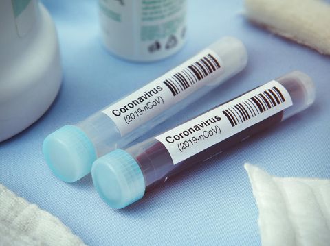 Mutasi Virus Corona Paling Berbahaya, Menginfeksi Manusia dengan Cepat