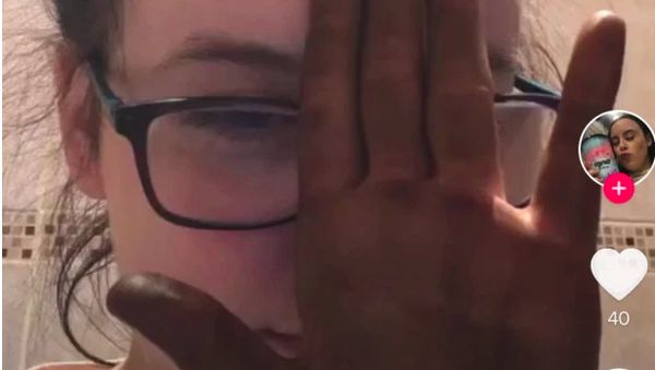 Deretan Foto Kocak Pengguna TikTok yang Gagal Gelapkan Kulit Saat Isolasi