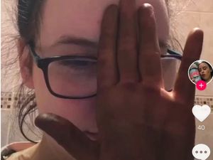 Deretan Foto Kocak Pengguna TikTok yang Gagal Gelapkan Kulit Saat Isolasi