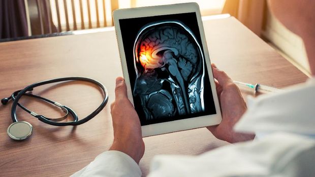 Doctor holding a digital tablet with x-ray of brain and skull skeleton. Headache, meningitis and migraine concept with stethoscope and syringe on the desk