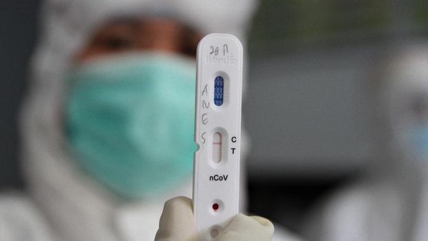 RAPID TEST JURNALIS DI KENDARI Petugas medis menunjukan rapid test atau pemeriksaan cepat COVID-19 yang diambil dari salah satu sampel darah jurnalis di Kantor Dinas Komunikasi dan Informatika Provinsi Sulawesi Tenggara, Kendari, Sulawesi Tenggara, Selasa (07/4/2020). Pihak Dinas Komunikasi dan Informatika Provinsi Sulawesi Tenggara bekerja sama dengan Ahli Teknologi Laboratorium Medik (ATLM) Kendari melakukan pemeriksaan rapid test kepada para jurnalis di Kendari sebab berpotensi terpapar virus COVID-19 saat melakukan peliputan. ANTARA FOTO/Jojon/foc.