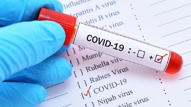 Blood sample tube positive with COVID-19 virus or novel coronavirus 2019 found in Wuhan, China